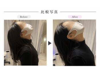 リラボ整体院 赤坂店(RE+LAB=◯整体院)の写真/国家資格者による一時的ではない根本改善を。/麻布/麻布十番/赤阪/赤阪見附/整体/小顔