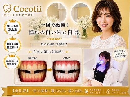 ココティ ホワイトニング(Cocotii)の写真