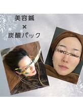 サクラ(Sakura)/美肌潤いコース★鍼×炭酸パック