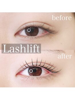 ファンドットジェルム(Fan.germe)/ラッシュリフト