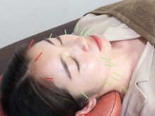 高橋整骨院鍼灸院/美容鍼