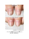 最強のネイルケア３ケ月間コース