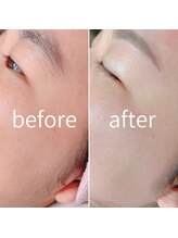 ランプシー(Lampsi)/Waxでうぶ毛を処理