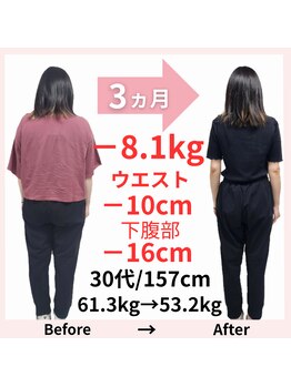 おもいやり鍼灸治療院 モーイ(mooi)/鍼灸痩身ダイエット