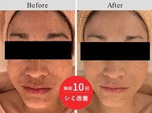 サロンドリュッカ(Salon de Lycka)の雰囲気（40代女性/美白シミケアフェイシャルエステ/小顔/毛穴/ヘッドスパ）