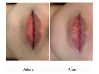 フラックスアンドビューティー(flax&BEAUTY)/Face wax / miyu