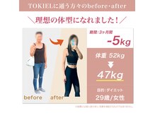 トキエル 金山 東別院店(TOKIEL)/ボディメイク/筋膜リリース