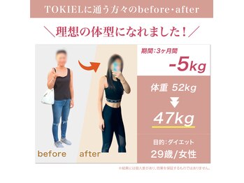 トキエル 金山 東別院店(TOKIEL)/ボディメイク/筋膜リリース