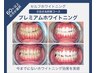 【人気No.1】プレミアムホワイトニング★最短で白くなりたい方★
