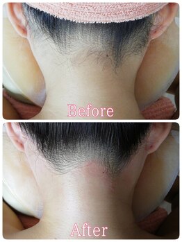 ベイジョ デ アンジョ(Beijo de anjo)/うなじシュガーリング