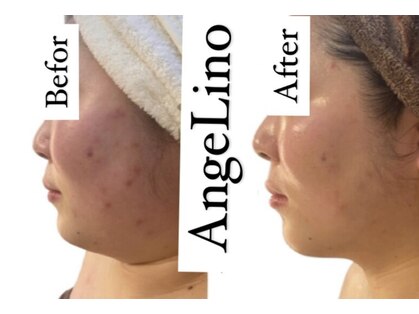 アンジェリーノ(AngeLino)の写真