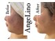 アンジェリーノ(AngeLino)の写真