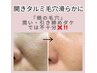 【毛穴引締め・美白ケア】フォト光フェイシャル/回数券をご利用の方