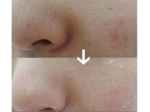 ケイココ(Keicoco)/