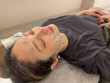 とまり木鍼灸整骨院/