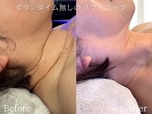 ミスティア(mistia)の雰囲気（頭の先から足裏まで◎ハイパワー最新機器導入！結果重視エステ♪）