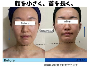 お顔の研究所/ビフォーアフター写真♪