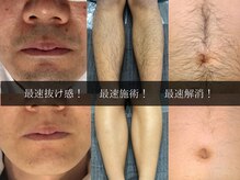 【メンズ脱毛】ツルツル派/減毛派！肌荒れ改善・ムレや臭い予防