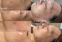 ヨルエステ(yoru aesthe)