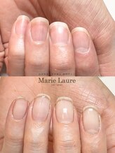マリーロール 梅田店(Marie Laure)/自爪育成/深爪矯正/ネイルケア