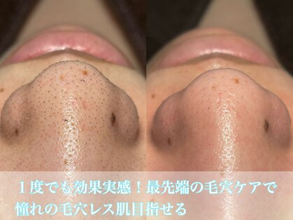 ビエン(bien)の写真