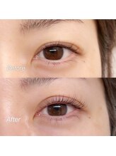 ネイルサロン レン(Ren)/まつ毛パーマ/ラッシュリフト