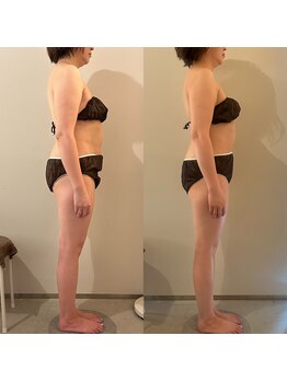 ラナ 京都西院店(Lana)/黄土漢方よもぎ蒸し＆マッサージ