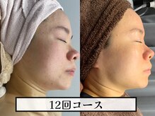 【実績】 40代・50代でも若々しい見た目へ！