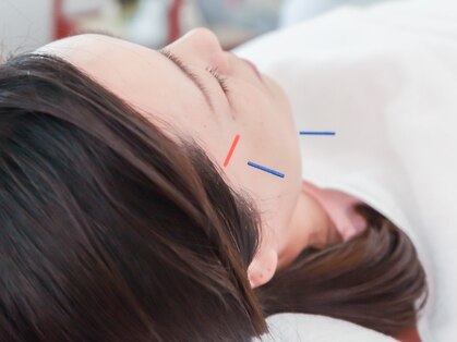 美容鍼灸salonまつもとの写真