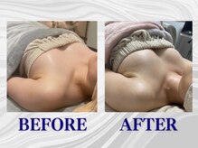 ザモア 福岡天神(THE MORE)/【症例 Before After】