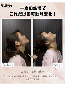 トゥーアズ シャロン(toAZ SHARON)/【鍼灸/首こり】首の可動域UP!