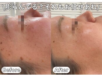 ベルファーム(Belle Femme)/