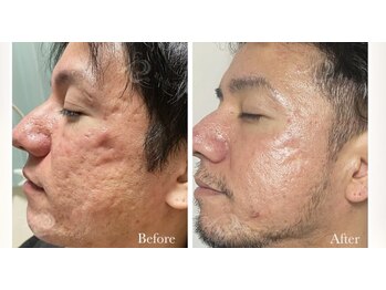 セレネ(SELENE)/お肌にお悩みがある方へ