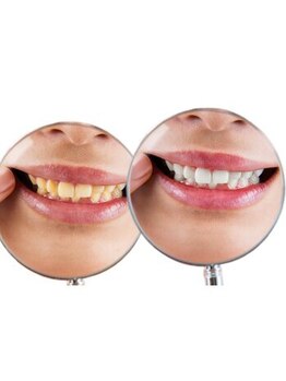 NAホワイトニング 船橋店/セルフホワイトニング/船橋