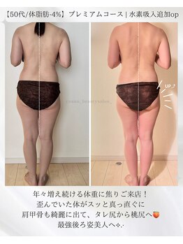 ヨサパーク ユアン(YOSA PARK yuann)/50代/諦めていた痩身に大成功!