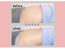 リリーフ(relief)の雰囲気（腸もみ1回でお腹-4cm!【腸もみ/リンパ/デトックス/ダイエット】）