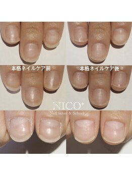 ニコプラス(NICO+)/ジェルネイルができない方向け
