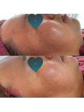 ホナ(HONA)/メンズ様にも人気