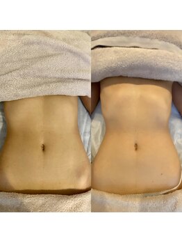 エミナル(EMINALu)/呼吸で肋骨を締める