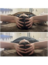 モア(moa)/小顔ケア