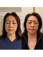 こうぞう整体院/美容鍼×筋膜リリース