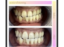 エクシアホワイト 平岸駅前店/