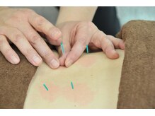 一二三はりきゅう院/鍼灸/腰痛/骨盤矯正/肩こり/頭痛