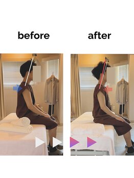 フィデル(fidele)/デスクワーク由来の頚肩凝り例