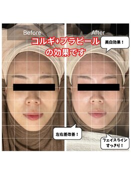 チョアチョア 札幌すすきの店(CHOA-CHOA)/下地オプション追加で効果UP★