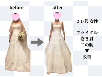 天白はら整体院アクト/ブライダル/小顔/巻き肩/猫背