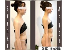 3~5月挙式&駆け込み花嫁様多数来店。至高の鎖骨・肩甲骨メソッド