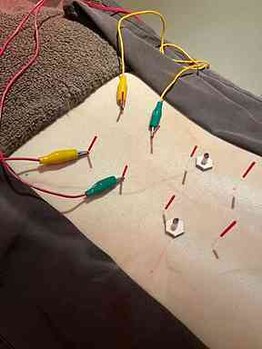 高田馬場はりきゅう院/腰のコリ・重さへの鍼灸