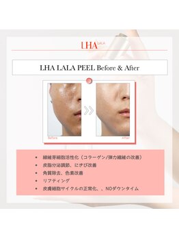 シエル(Ciel)/ララピール