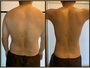 リズビー(Lisbe)の写真/理想の体を目指すメンズ必見!内臓脂肪を徹底撃退して、理想のサイズダウンをサポートします☆